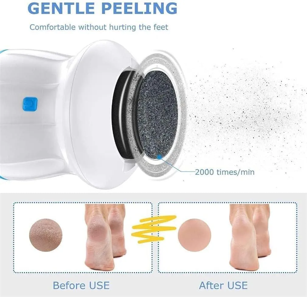 Electric Callus Remover with Built-In Vacuum & Foot Grinder Head